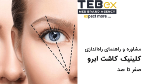 راه اندازی کلینیک کاشت ابرو