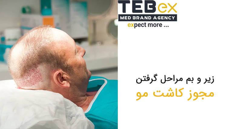 مراحل گرفتن مجوز کاشت مو