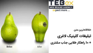 خلاقانه ترین متن تبلیغات کلینیک لاغری