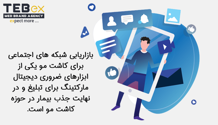 1tebex-temp[ate-min (17) جذب مشتری کاشت مو از طریق شبکه های اجتماعی